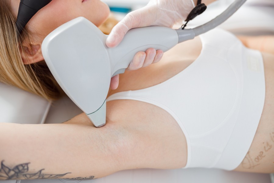 Comment reconnaître une épilation laser ratée ?