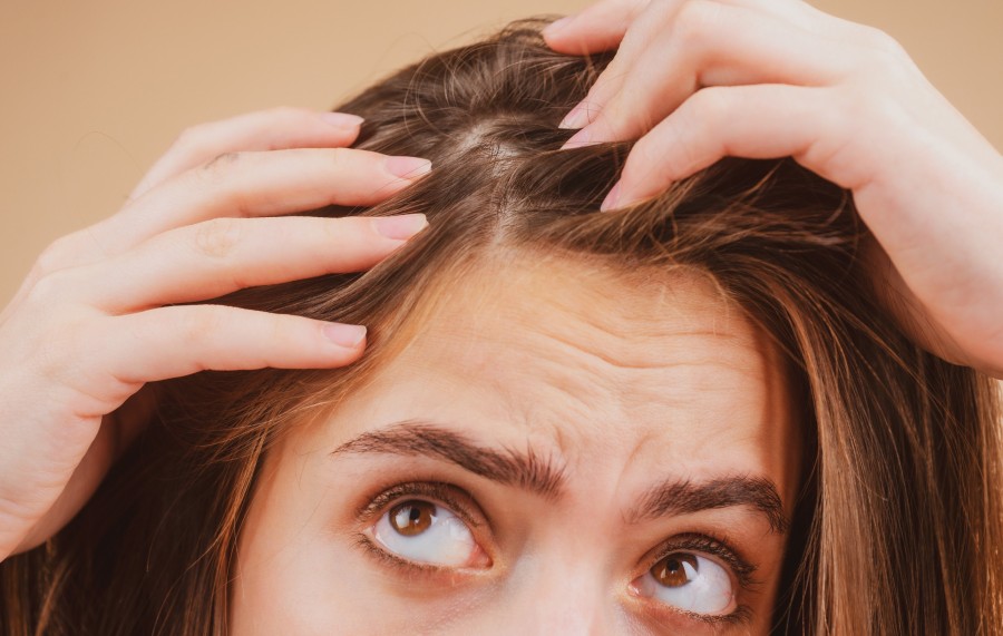Pourquoi mon cuir chevelu me fait-il mal ?