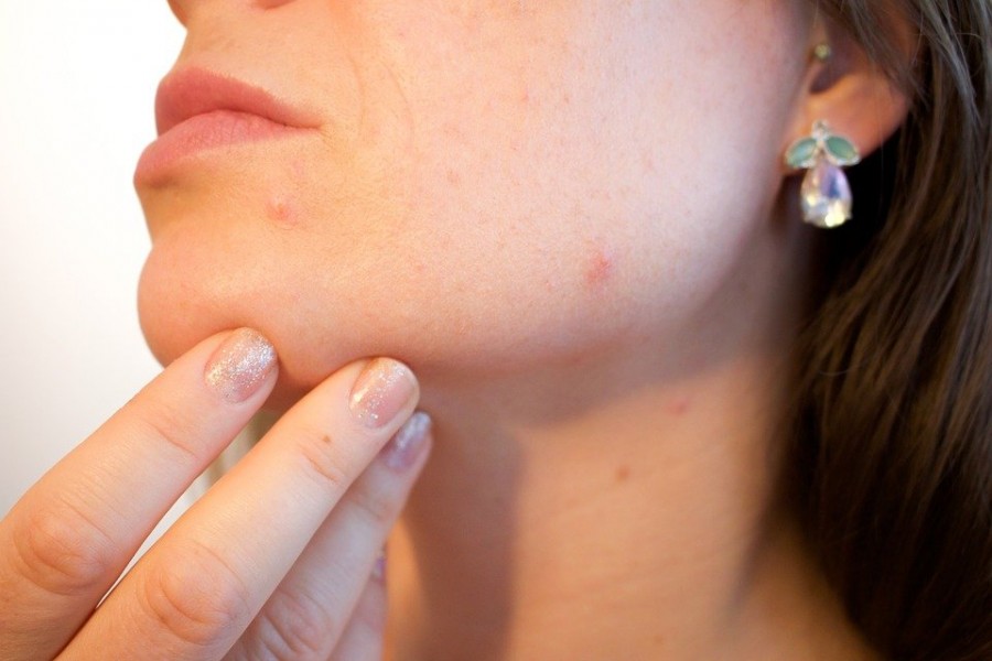 Pore dilaté : comment laisser la peau respirer ?