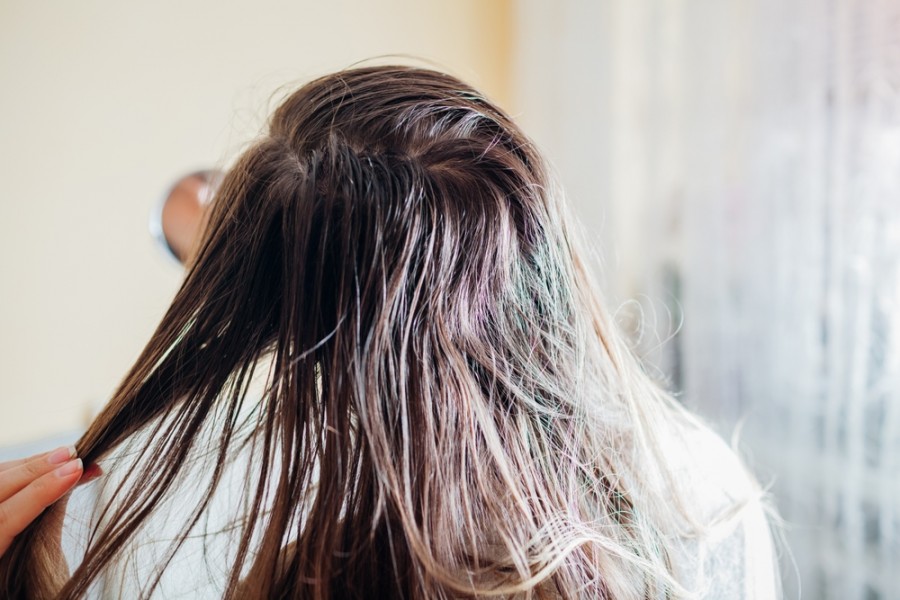 Pourquoi mes cheveux sont-ils poisseux derrière la tête ? Pourquoi mes cheveux sont-ils poisseux derrière la tête ?